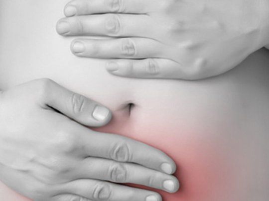 Endometriosis.