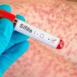 El Boletín Epidemiológico Nacional alertó sobre una suba sostenida de los casos de sífilis y volvió a poner el foco en la prevención, el diagnóstico temprano y el acceso oportuno al tratamiento. El Boletín Epidemiológico Nacional alertó sobre una suba sostenida de los casos de sífilis y volvió a poner el foco en la prevención, el diagnóstico temprano y el acceso oportuno al tratamiento.