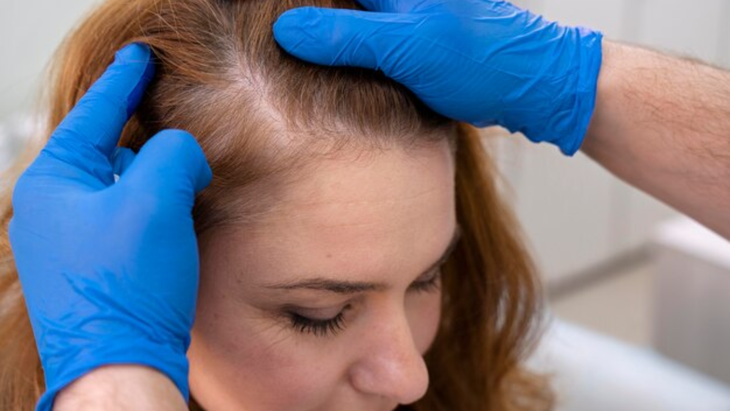Cuál es el motivo por el que aparecen las canas, según un estudio de Harvard Cuál es el motivo por el que aparecen las canas, según un estudio de Harvard