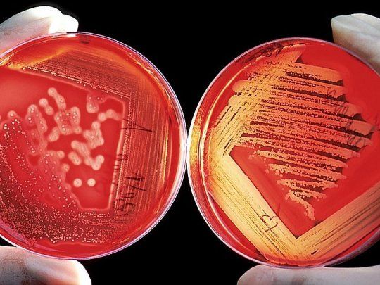 bacteria nueva_1000.jpg