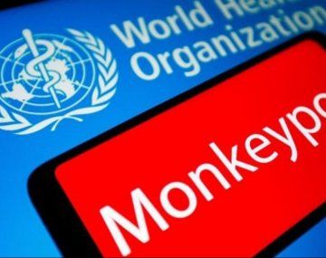 Viruela del mono: la OMS analiza cambiarle el nombre