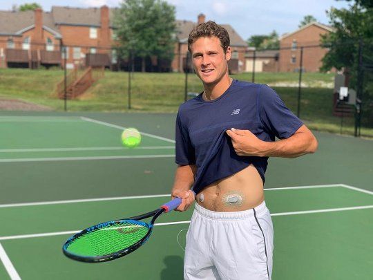 Aragone tiene un pequeño dispositivo en el cuerpo que controla sus niveles de azúcar y lo puede observar mientras juega al tenis.