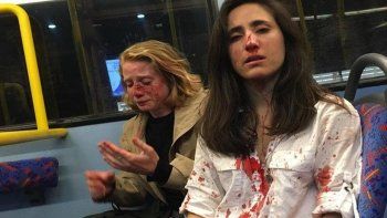 hay ya cinco detenidos por brutal golpiza a joven uruguaya y su novia en londres