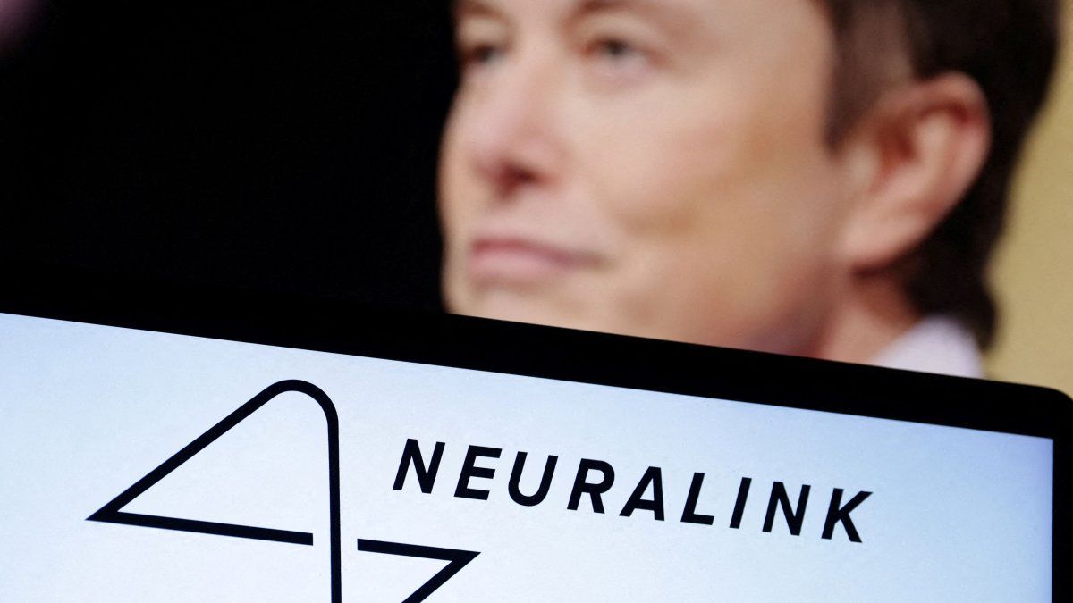 Elon Musk’s chip that restores sight to blind people has been approved in the US