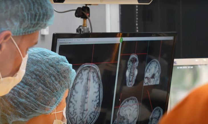 La intervención se realizó sin anestesia general, con monitoreo constante de funciones cognitivas y emocionales. La intervención se realizó sin anestesia general, con monitoreo constante de funciones cognitivas y emocionales.