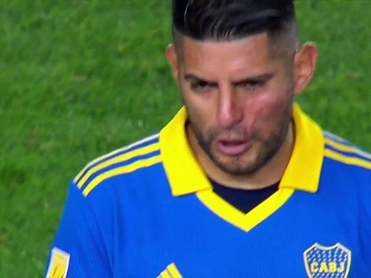 Golpe. Así salía Zambrano a jugar el segundo tiempo con Racing tras la pelea con Benedetto en el entretiempo.