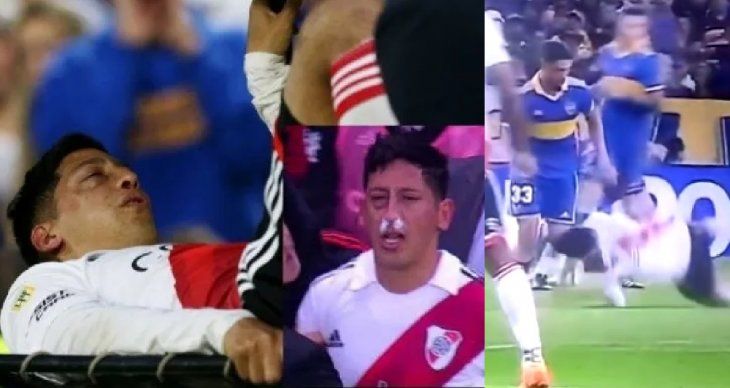 Operaron a Aliendro tras la fractura que le hizo Varela: ¿cuántos meses estará afuera?