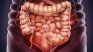 Cuatro frutas que ayudan a prevenir el cáncer de colon.