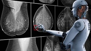 Inteligencia Artificial para detectar el cáncer de mama